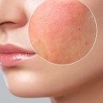 Makeup Side Effects: రోజూ మేకప్ వేస్తున్నారా ? అయితే ఈ సమస్యలు తప్పవు