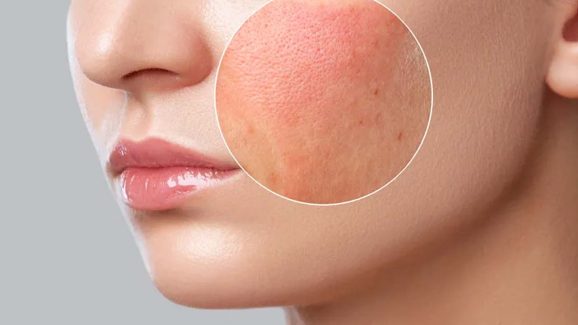 Makeup Side Effects: రోజూ మేకప్ వేస్తున్నారా ? అయితే ఈ సమస్యలు తప్పవు