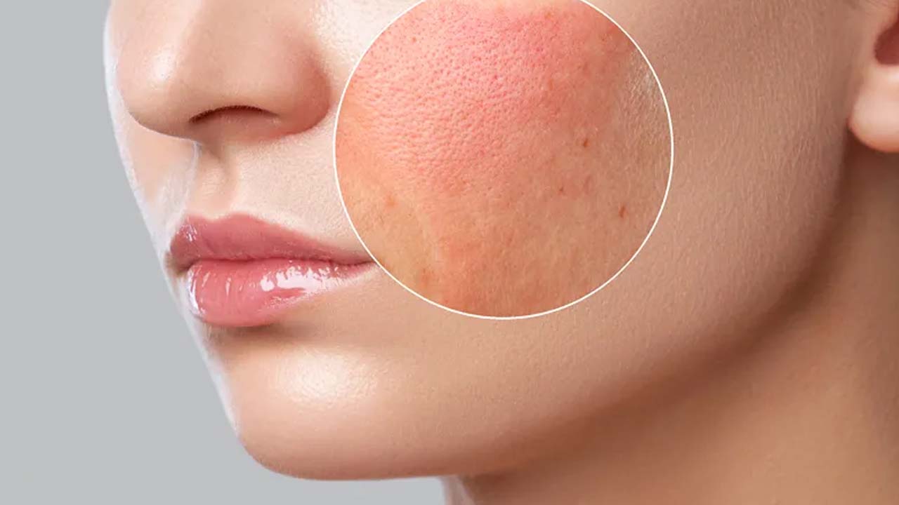 Makeup Side Effects: రోజూ మేకప్ వేస్తున్నారా ? అయితే ఈ సమస్యలు తప్పవు
