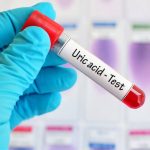 Ayurveda for Uric Acid: ఆయుర్వేద చిట్కాలతో యూరిక్ యాసిడ్ లెవెల్స్ తగ్గుతాయా..? వైద్యులు ఏం చెప్తున్నారంటే
