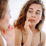 Pimples: మొటిమలు ఎందుకు వస్తాయి? వీటిని తగ్గించుకోవాలంటే ఏం చేయాలి?