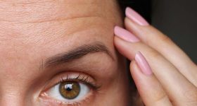 Wrinkles: చిన్న వయసులోనే చర్మంపై ముడతలా? ఇలా చేస్తే అంతా సెట్..