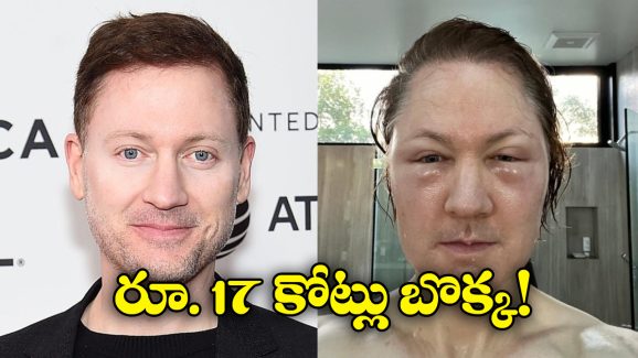 Biohacker Bryan: యవ్వనం కోసం ప్రయత్నిస్తే ముసలితనం.. బెడిసి కొట్టిన ప్రయోగం!