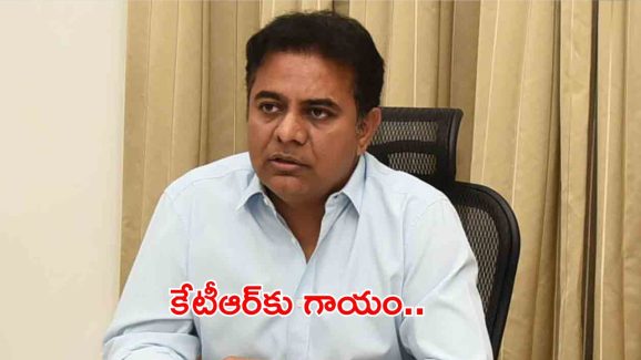 BIG BREAKING: కేటీఆర్‌కు గాయం..