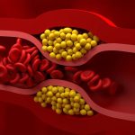 Bad cholesterl : చెడు కొలెస్ట్రాల్ చింత ఎందుకు.. వీటిని తింటే అంతా సెట్..