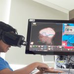 Virtual Reality Surgery: వర్చువల్ రియాలిటీతో బ్రెయిన్ సర్జరీ..ఓ చిన్నారి జీవితాన్ని మార్చిన టెక్ మాయాజాలం