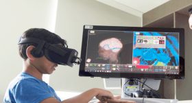 Virtual Reality Surgery: వర్చువల్ రియాలిటీతో బ్రెయిన్ సర్జరీ..ఓ చిన్నారి జీవితాన్ని మార్చిన టెక్ మాయాజాలం