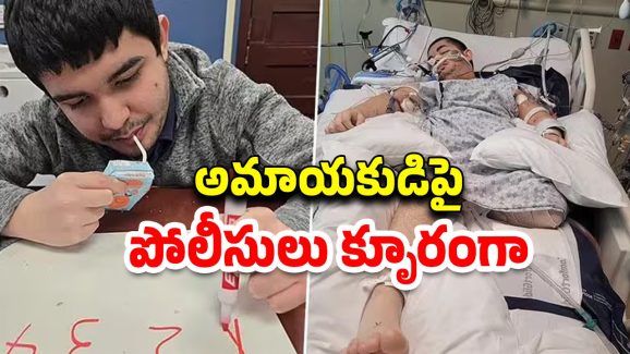 Police Shot Autistic Boy: మతి స్థితిమితం లేని యువకుడిపై కాల్పులు జరిపిన పోలీసులు.. 10 రోజులుగా కోమాలో..