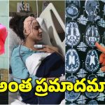 Ashu reddy Brain Surgery: అషు రెడ్డి బ్రెయిన్‌కు ఏమైంది? ఇలాంటి సమస్యలు మీకూ రావచ్చు, కారణాలు ఇవే