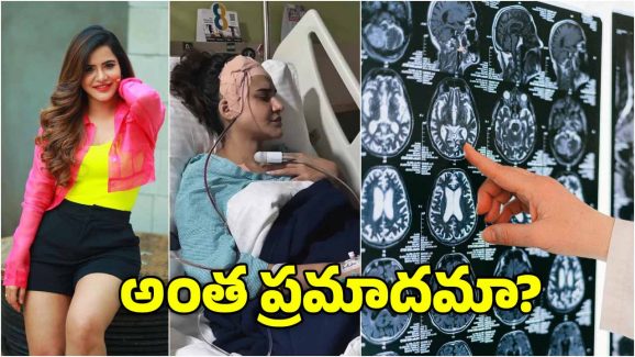 Ashu reddy Brain Surgery: అషు రెడ్డి బ్రెయిన్‌కు ఏమైంది? ఇలాంటి సమస్యలు మీకూ రావచ్చు, కారణాలు ఇవే