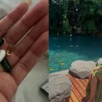 Rashmi Gautam: ఎట్టకేలకు సర్జరీ పై ఓపెన్ అయిన రష్మీ.. ఇంత బాధ అనుభవించిందా.?