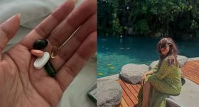 Rashmi Gautam: ఎట్టకేలకు సర్జరీ పై ఓపెన్ అయిన రష్మీ.. ఇంత బాధ అనుభవించిందా.?