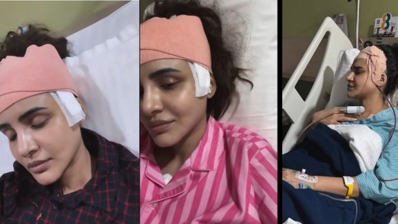 Ashu Reddy: ఆర్జీవీ బ్యూటీకి బ్రెయిన్ సర్జరీ… చూస్తే కన్నీళ్లు ఆగవు