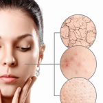 Dry Skin Tips: డ్రై స్కిన్ సమస్యా ? సమ్మర్‌లో ఈ టిప్స్ ఫాలో అవ్వండి !