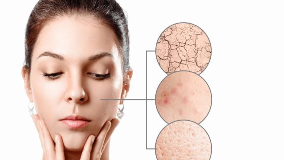 Dry Skin Tips: డ్రై స్కిన్ సమస్యా ? సమ్మర్‌లో ఈ టిప్స్ ఫాలో అవ్వండి !