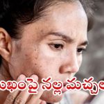 Dark Spots: ముఖంపై నల్ల మచ్చలా ? ఇలా చేస్తే.. ప్రాబ్లమ్ సాల్వ్