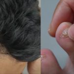Hair loss in Buldhana: పల్లెల్లో వింత వ్యాధులు..! అసలు కారణం ఇదే..