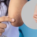 Dark Elbows: మోచేతులు నల్లగా మారాయా ? ఇలా చేస్తే.. క్షణాల్లోనే మెరిసిపోతాయ్