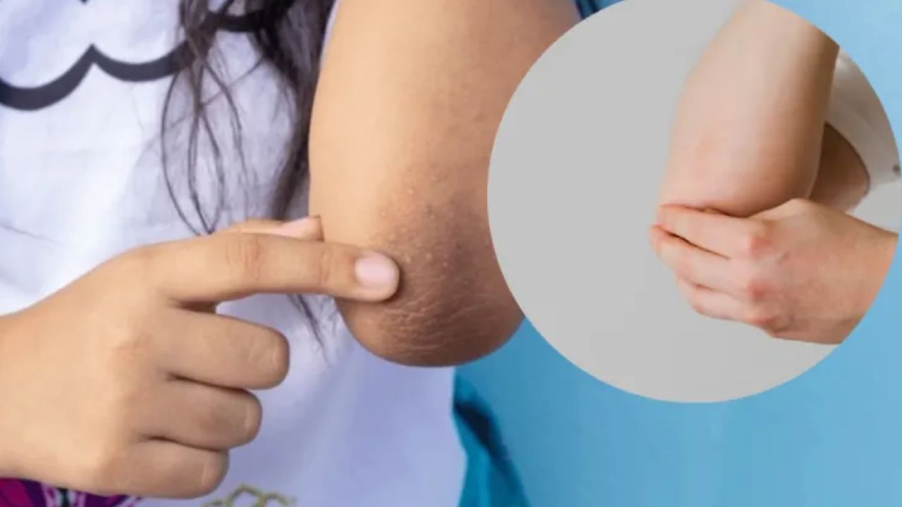 Dark Elbows: మోచేతులు నల్లగా మారాయా ? ఇలా చేస్తే.. క్షణాల్లోనే మెరిసిపోతాయ్