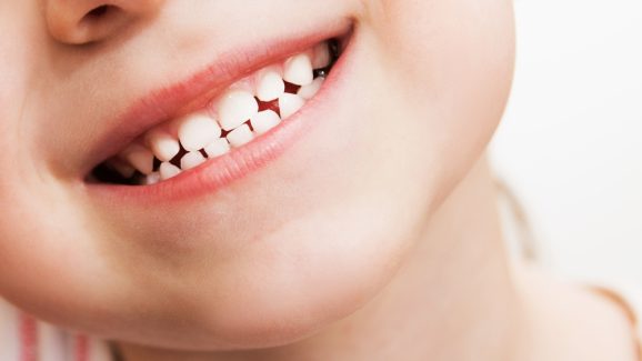 Milk Tooth: చంటి పిల్లలకు వచ్చిన పళ్లు 12 ఏళ్లకు ఎందుకు ఊడిపోతాయి?