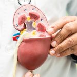 Kidney Care: మీ కాళ్లు ఇలా అవుతున్నాయా? జాగ్రత్త.. కిడ్నీల సమస్య కావచ్చు
