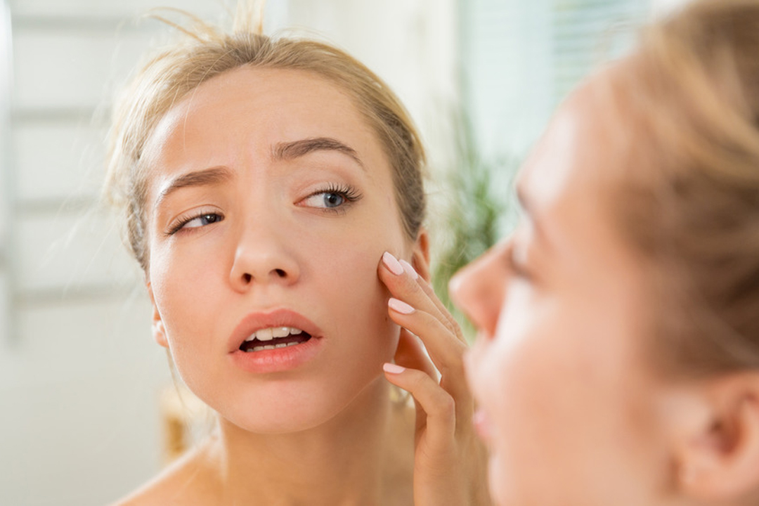 Puffy Face: తరచు మొహం ఉబ్బిపోయినట్టుగా అనిపిస్తోందా? కారణం అదే కావచ్చు..!