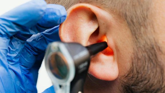 Ear Care: కాటన్ బడ్స్ వాడితే చెవుడు వస్తుందట.. మరి క్లీన్ చేసుకోవడమెలా?