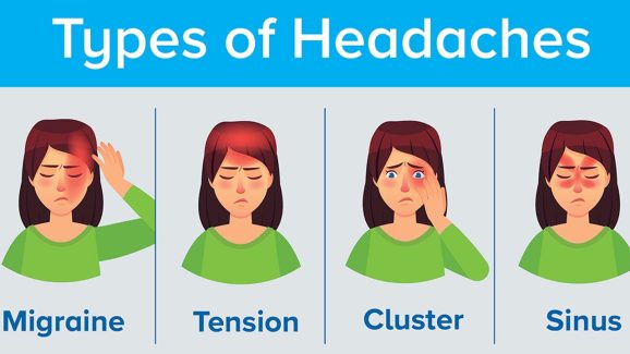 Types Of Headache: అసలు తలనొప్పి ఎన్ని రకాలో తెలుసా ?