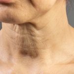 Wrinkles On Neck: ముడతలు లేకుండా యవ్వనంగా కనిపించాలంటే.. ఇలా చేయండి !