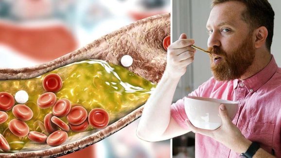 Cholesterol Control Tips: శరీరంలో అధిక కొలెస్ట్రాల్ తగ్గాలంటే.. ఇలా చేయండి !