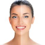 Tan Removing Face Pack: ముఖంపై ట్యాన్ తొలగిపోయి.. అందంగా మెరిసిపోవాలంటే ?