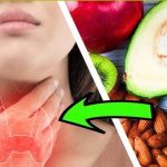 Thyroid: థైరాయిడ్ ఉన్న వాళ్లు ఏం తినాలి ? ఏం తినకూడదు ?