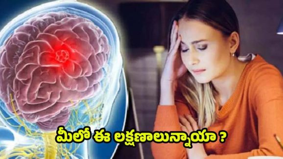 Brain Tumor: తరచూ తలనొప్పితో పాటు ఈ లక్షణాలు మీలో ఉన్నాయా ? అయితే జాగ్రత్త