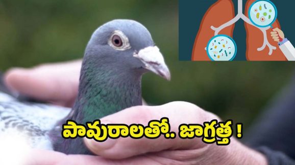 Pigeons: పావురాలతో యమ డేంజర్ ? ఇలా చేస్తే.. ప్రాణాలకే ప్రమాదం !