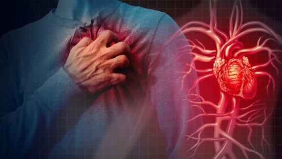 Heart Attack: హార్ట్ ఎటాక్ రాకుండా ఉండాలంటే ?