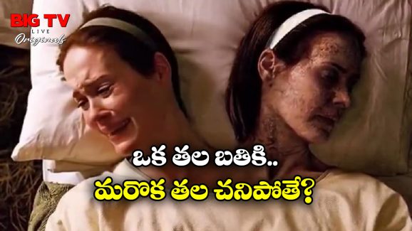 Conjoined Twin: అవిభక్త కవలల్లో ఒకరు చనిపోతే? మరొకరి పరిస్థితి ఏంటి?