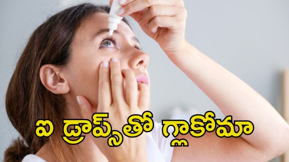 Eye Drops Glaucoma: ఐ డ్రాప్స్‌తో డేంజర్.. దేశంలో పెరిగిపోతున్న గ్లాకోమా కేసులు