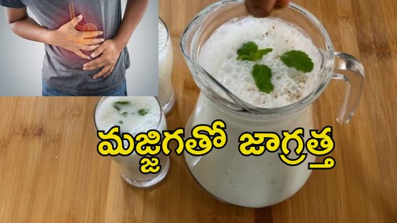 Buttermilk Side Effects: మజ్జిగ అందరికీ ఆరోగ్యకరం కాదు.. అలాంటివారికి ఆరోగ్య సమస్యలు