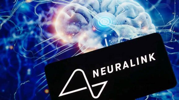 Neuralink Chip: న్యూరాలింక్ చిప్‌కు ఆమోదం.. వీరికి గొప్ప వరం, కళ్లు లేకున్నా కూడా..