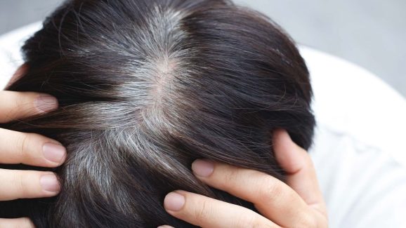 Tips For White Hair: తెల్ల జుట్టుతో ఇబ్బంది పడుతున్నారా ? ఇలా చేస్తే.. ప్రాబ్లమ్ సాల్వ్