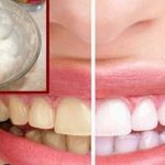 Tips For White Teeth: ఉప్పులో ఈ ఒక్కటి కలిపి వాడితే.. పళ్లు తెల్లగా మెరుస్తాయ్