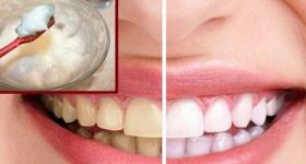 Tips For White Teeth: ఉప్పులో ఈ ఒక్కటి కలిపి వాడితే.. పళ్లు తెల్లగా మెరుస్తాయ్