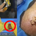 MI’s 4th IPL Title: కాలుకు 7 కుట్లు..రక్తం కారుతోంది..అయినా ముంబైపై వాట్సన్ వీరోచిత బ్యాటింగ్