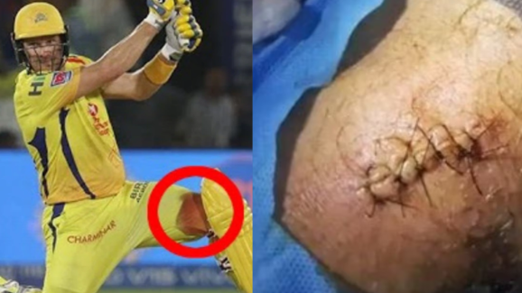MI’s 4th IPL Title: కాలుకు 7 కుట్లు..రక్తం కారుతోంది..అయినా ముంబైపై వాట్సన్ వీరోచిత బ్యాటింగ్