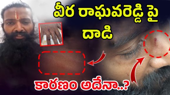 Veera Raghava Reddy: వీర రాఘవరెడ్డిపై 20 మంది దాడి..! ఏం జరిగిందంటే..