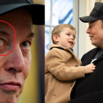 Elon Musk: కొడుకుతో తన్నులు తిన్న మస్క్ మామ.. పాపం కన్ను చూశారా ఎలా అయిపోయిందో!