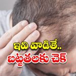 Bald Head: బట్టతలపై కూడా జుట్టు పెరగాలంటే.. ఈ టిప్స్ ఫాలో అవ్వండి !