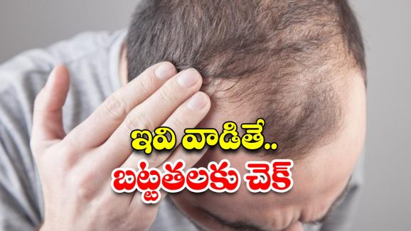 Bald Head: బట్టతలపై కూడా జుట్టు పెరగాలంటే.. ఈ టిప్స్ ఫాలో అవ్వండి !