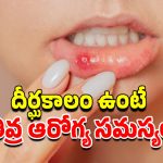 Mouth Ulcers Causes: నోటి పూతలు ఎందుకు వస్తాయి?.. నివారణకు ఈ జాగ్రత్తలు పాటించండి