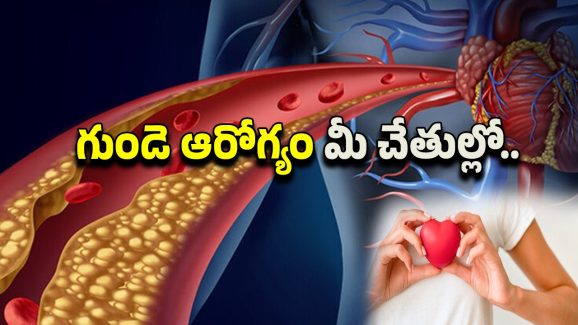Heart Attack Prevention: గుండె పోటు నివారణకు ప్రకృతిపరమైన చిట్కాలు.. ఇలా చేస్తే చెడు కొలెస్ట్రాల్ క్లీన్